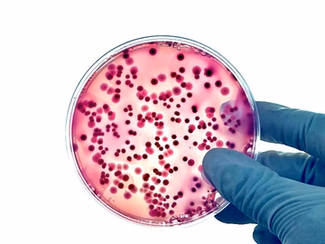 Goal: Solving Microbial Problems